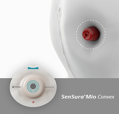 SenSura Mio Convex for stoma that sinks into your abdomen.