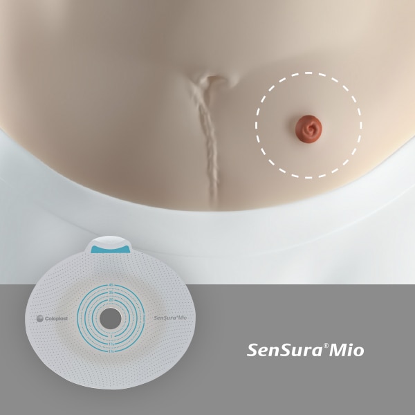 Is your stoma on a regular area?