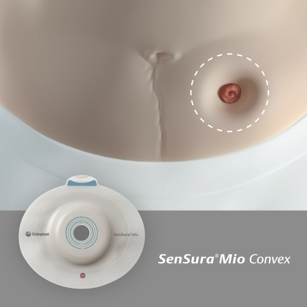 Is your stoma on an inward area? 
