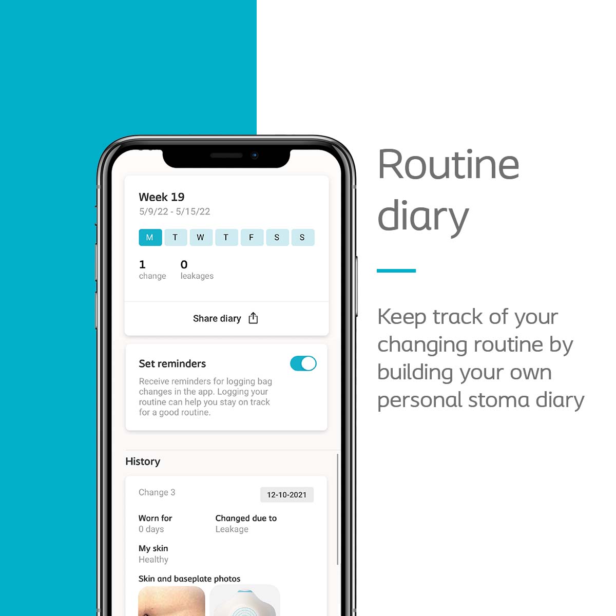 MyOstomy App Routine